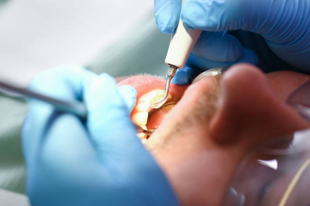 Best Urgent Dental Care for Toothache in Fowler, MI