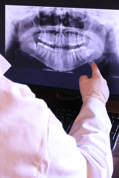 Best Emergency Dentist for Knocked-Out Tooth in Fowler, MI
