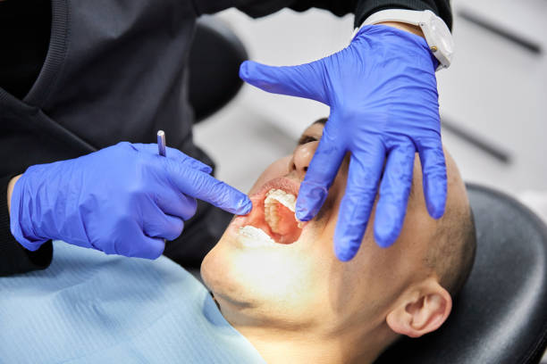 Best Emergency Dental Extractions in Fowler, MI